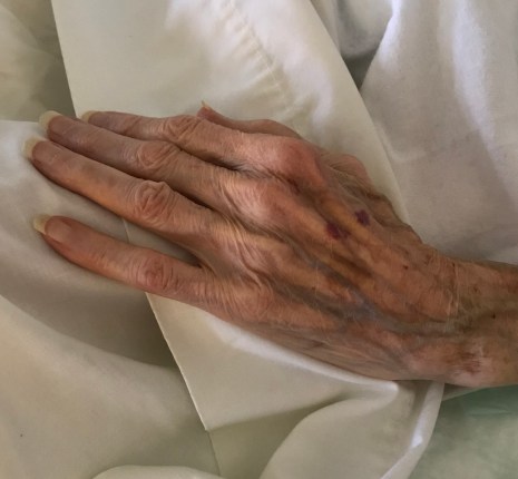 hand